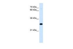Homeotic protein antennapedia Rabbit anti-Drosophila, Polyclonal, Novus Biologicals 100 &mu;g | Buy Online | Novus Biologicals | Fisher Scientific